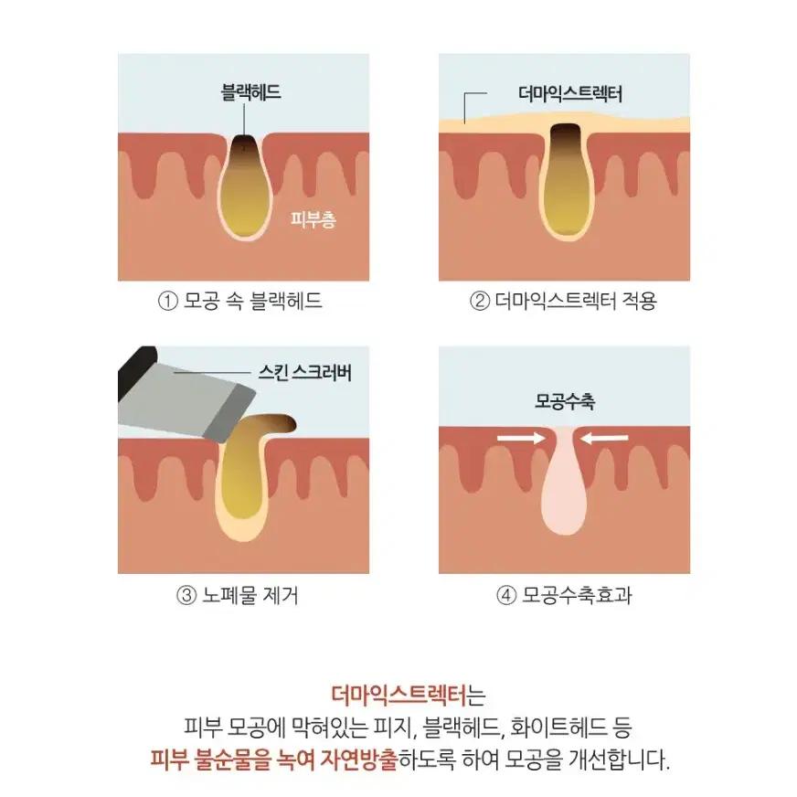 에비뉴랩 더마익스트렉터_1000ml/피지,화이트헤드,블랙헤드제거용액대용량