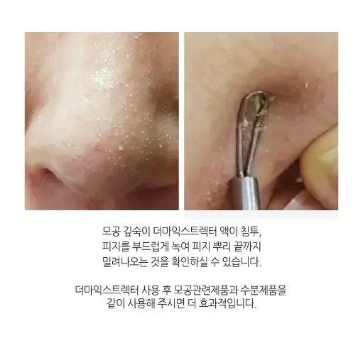 에비뉴랩 더마익스트렉터_1000ml/피지,화이트헤드,블랙헤드제거용액대용량