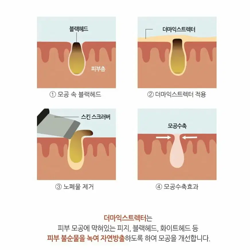 피지,화이트헤드,블랙헤드제거용액/에비뉴랩 더마익스트렉터_1000ml/피지