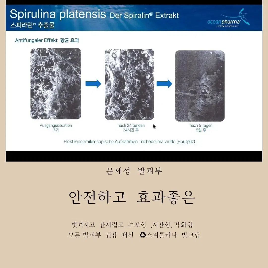 스피룰리나추출물사마귀티눈발각질프리젤프리겔한포진손가락물집발바닥물집수포아토피