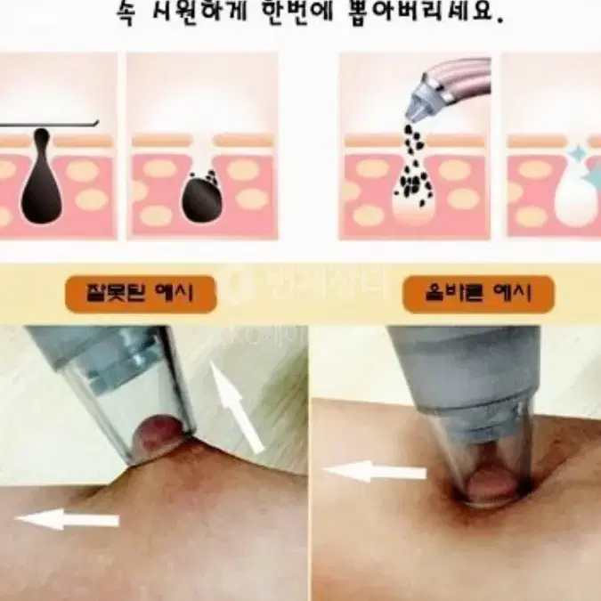 피지압출기