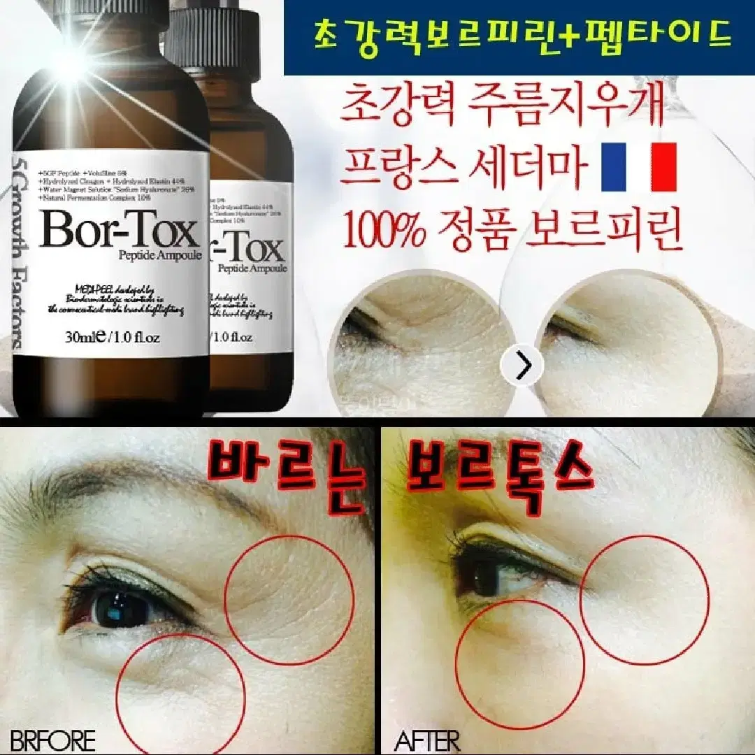 메디필 동안 볼륨 천연보톡스 보르톡스 주름지우개 향수네일팁 보르피린화장품