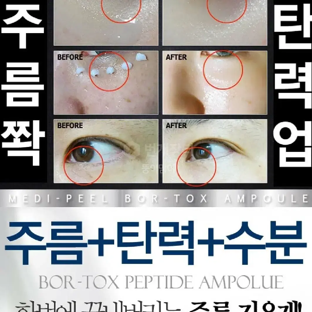 메디필 동안 볼륨 천연보톡스 보르톡스 주름지우개 향수네일팁 보르피린화장품