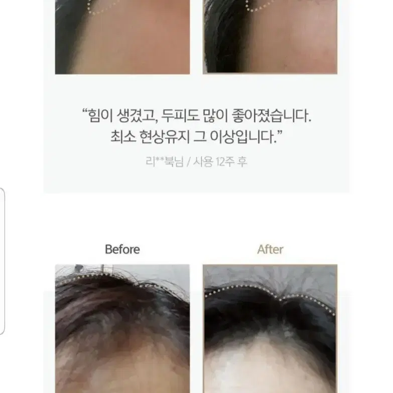 자이엘 헤어케어 탈모완화 스칼프샴푸 300ml+300ml리필