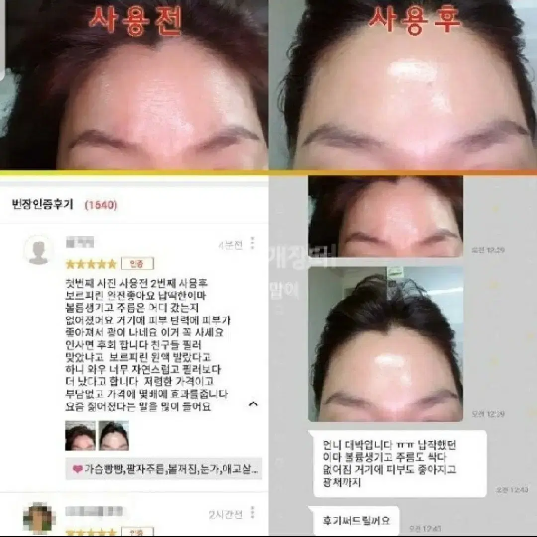 볼륨 이마 주름 콧대 볼꺼짐 눈밑 보르피린 화장품 에센스 앰플 메디필