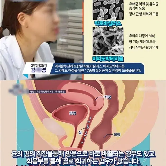 여성을 위한 유산균/질건강/장건강/질염 자궁건강 다이어트 네일팁