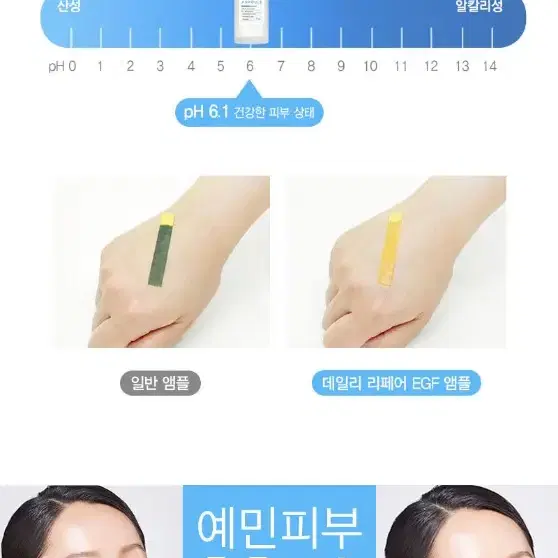 피부 재생 엠플