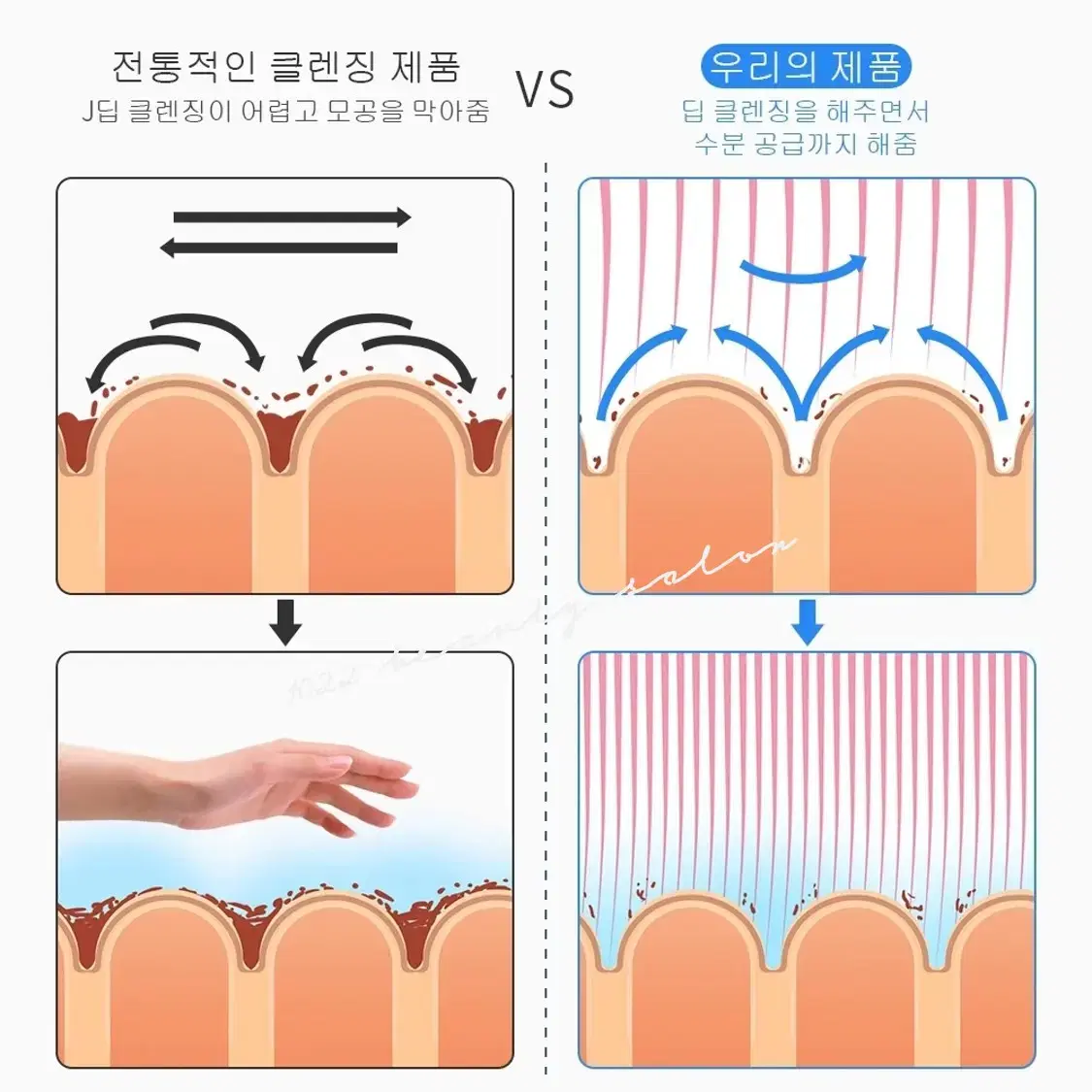 아쿠아필링 6가지 기능 하이드라 각질제거 피부미용기기