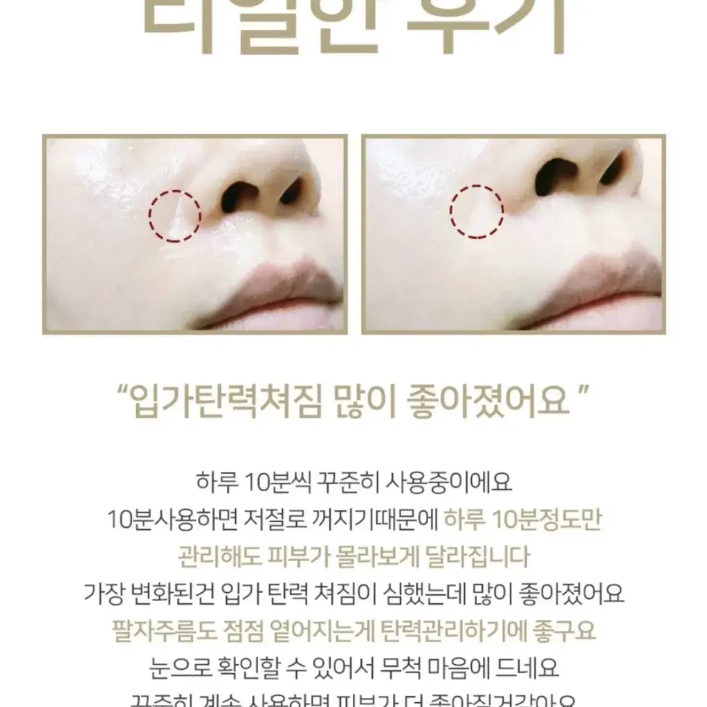 벨로큐* RF 갈바닉 리프팅 기계 (새상품)