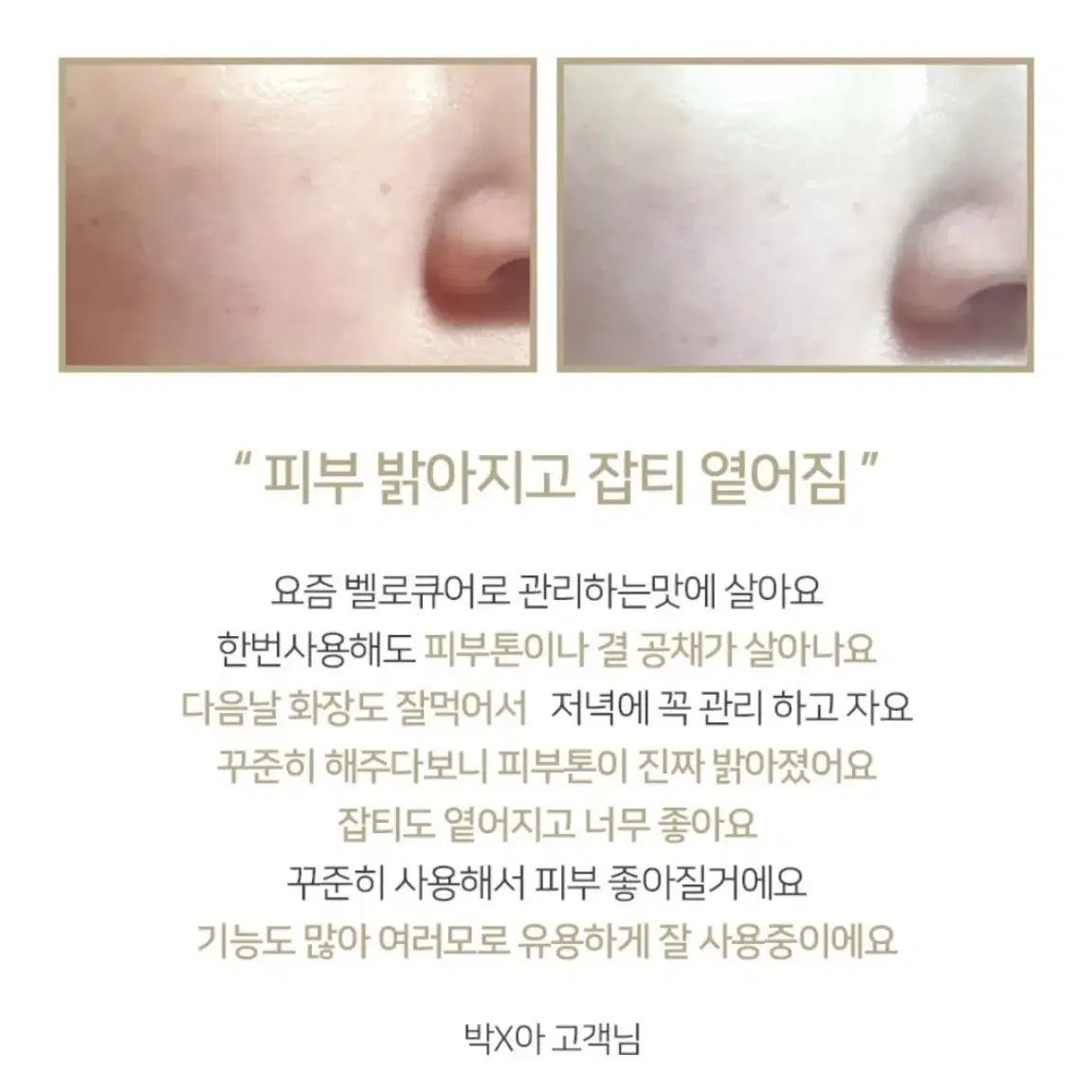 벨로큐* RF 갈바닉 리프팅 기계 (새상품)