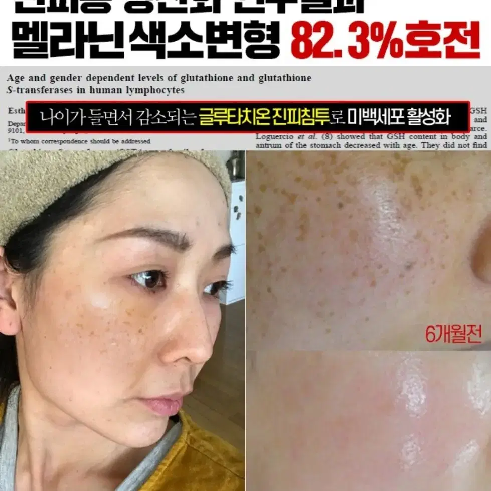 글루타치온크림 미백 기미 잡티 색소침착 우유빛 피부로 화장품 메디필네일팁