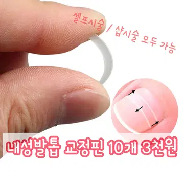 내성발톱 교정전용 핀 10개 | 브랜드 중고거래 플랫폼, 번개장터 내성발톱 교정전용 핀 10개 | 브랜드 중고거래 플랫폼, 번개장터