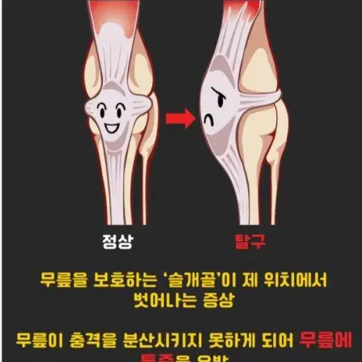 강아지 쓸개골탈구 관절지지대