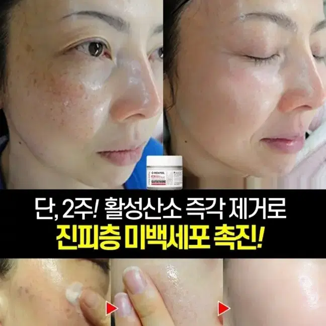 글루타치온 크림 미백 기미 잡티 색소침착 피부톤Up 우유빛 메디필 화장품