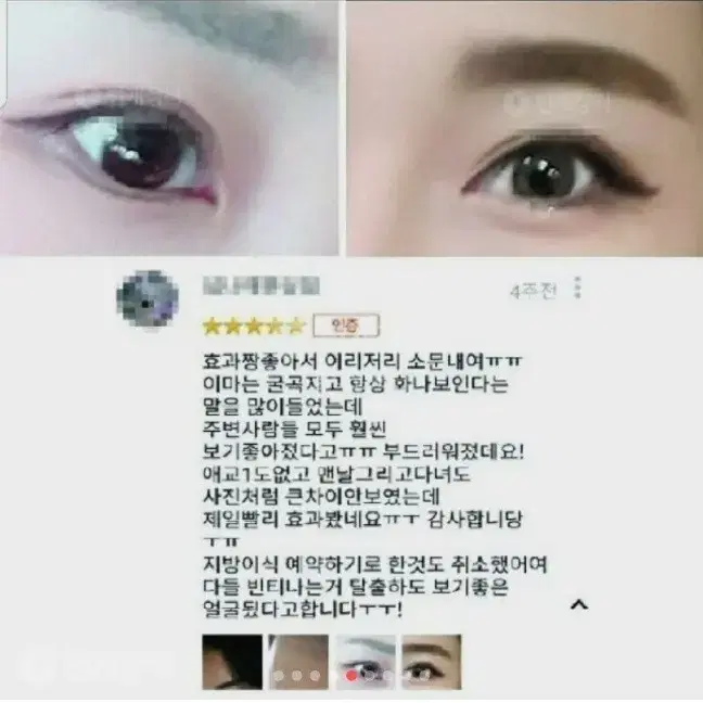 볼륨 이마 주름 콧대 볼꺼짐 눈밑애교살 보르피린앰플 화장품메디필