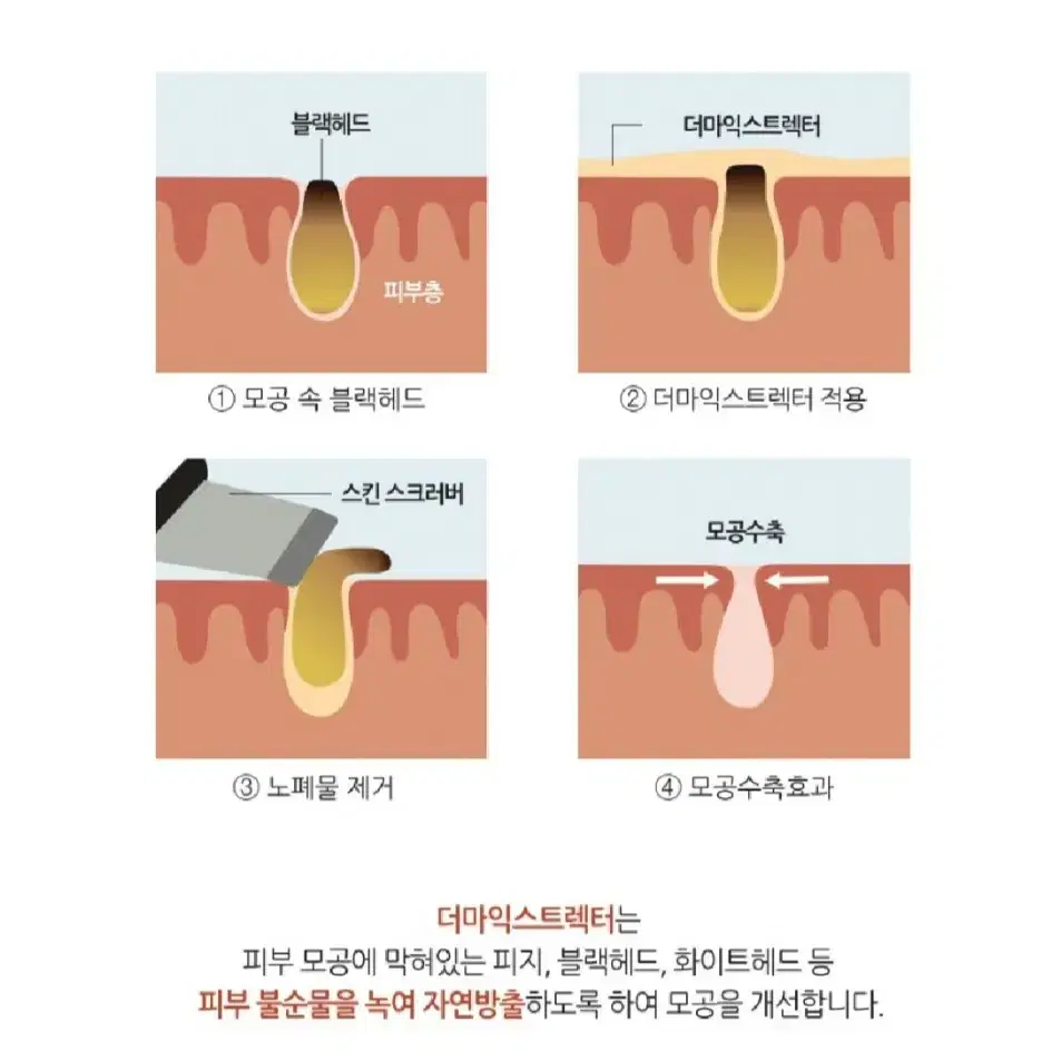 에비뉴랩 더마익스트렉터_1000ml 피지,화이트헤드,블랙헤드제거용액대용량