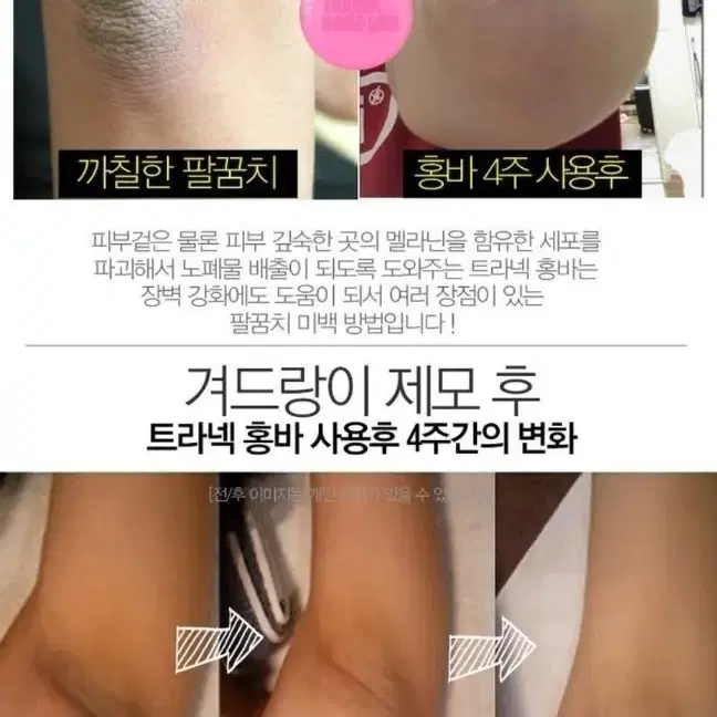 멜라닌 기미 색소침착/ 기미비누 색소침착 흉터 미백비누 메디필 화장품