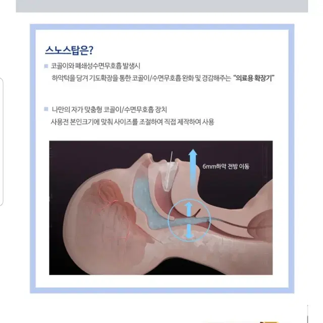 코골이방지 스노스탑 