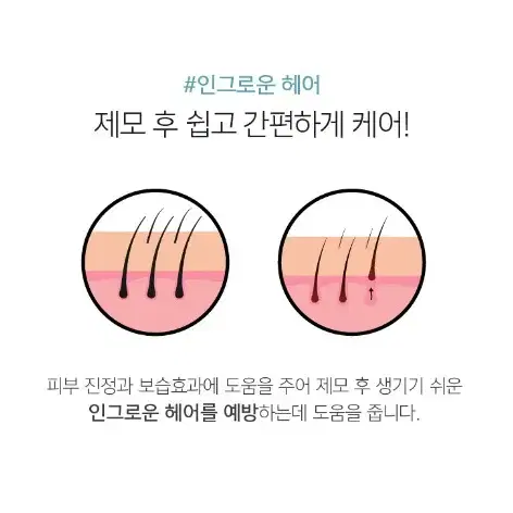 브라질리언 시트팩 자바뽀바 왁싱제모 관리 팩 비키니라인 브라질리언 라인