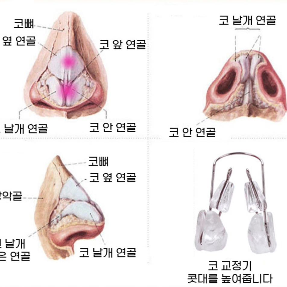 1+1  일본 코높이 코집게 코교정 콧대 볼륨 관리 뷰티