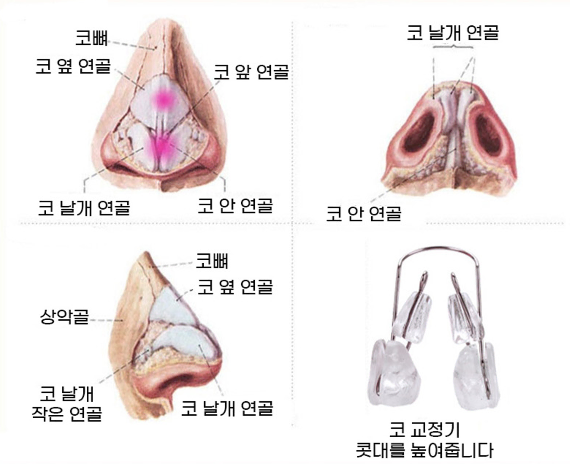 1+1  일본 코높이 코집게 코교정 콧대 볼륨 관리 뷰티