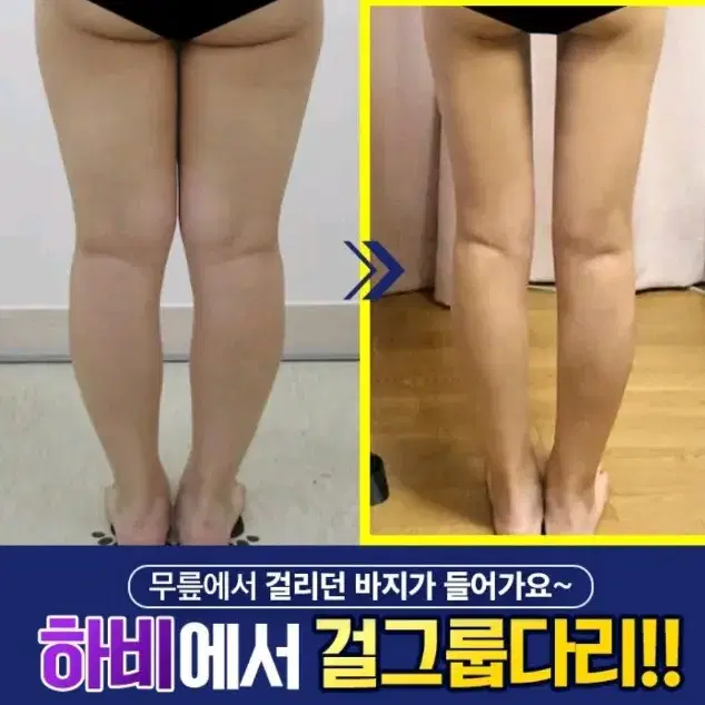 가벼운환 숙변배출 붓기제거 다이어트 지방감소 디톡스