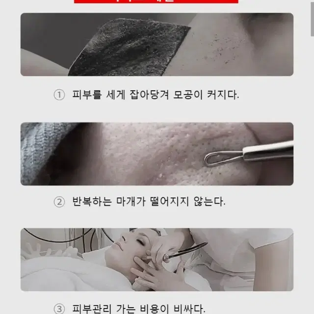 2일무료배송 모공 흡입기 진공 청소기 블랙헤드 얼굴 여드름 피지 제거