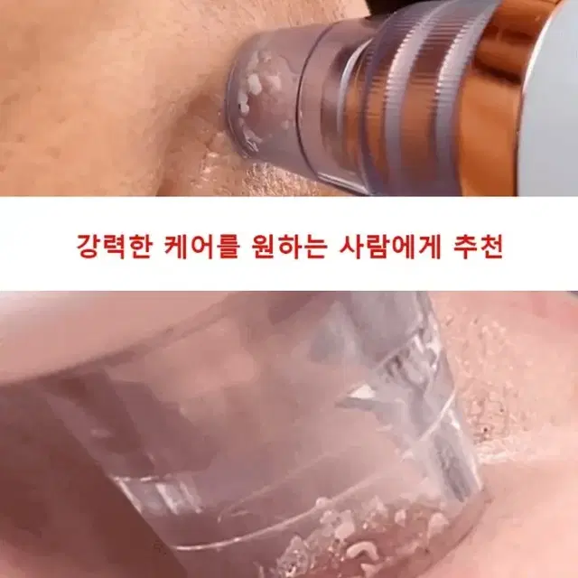 2일무료배송 모공 흡입기 진공 청소기 블랙헤드 얼굴 여드름 피지 제거