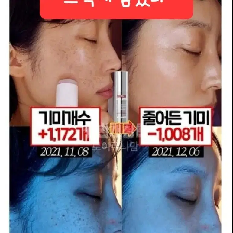 멜라닌 기미스틱 팔자주름 기미앰플 미백 탄력 주름지우개 검버섯 네일