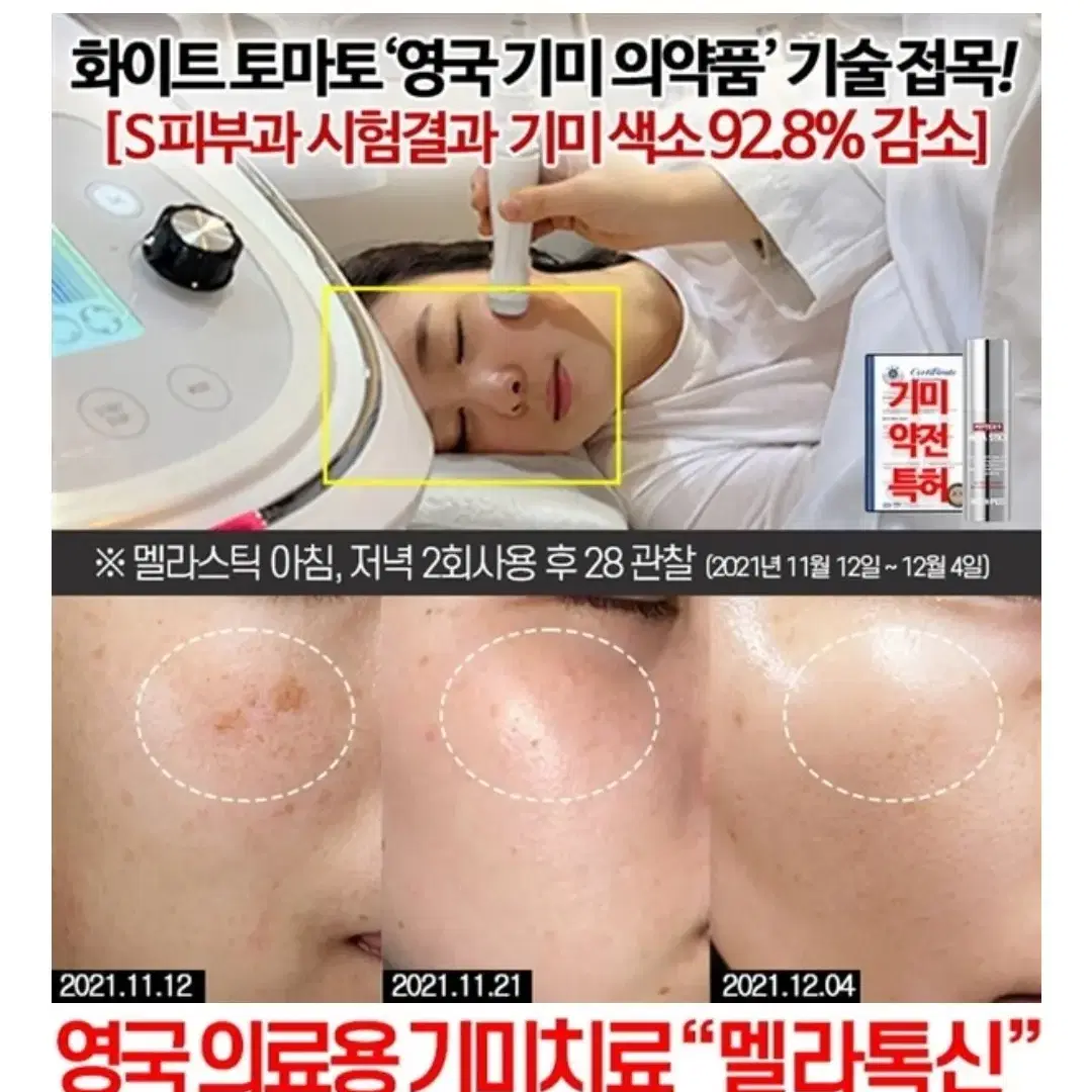 멜라닌 기미스틱 팔자주름 기미앰플 미백 탄력 주름지우개 검버섯 네일