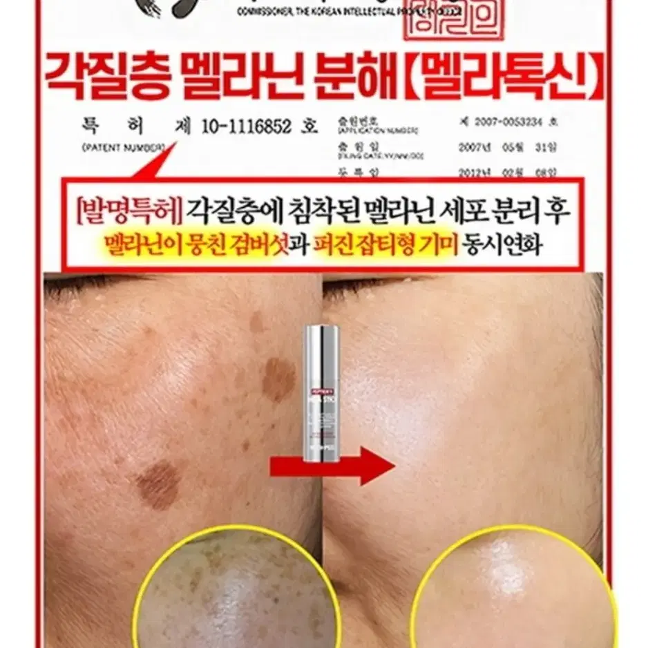 멜라닌 기미스틱 팔자주름 기미앰플 미백 탄력 주름지우개 검버섯 네일