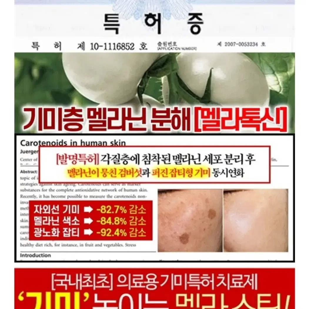 기미톡스 기미스틱 잡티스틱 기미앰플 미백 탄력 주름지우개  검버섯 네일