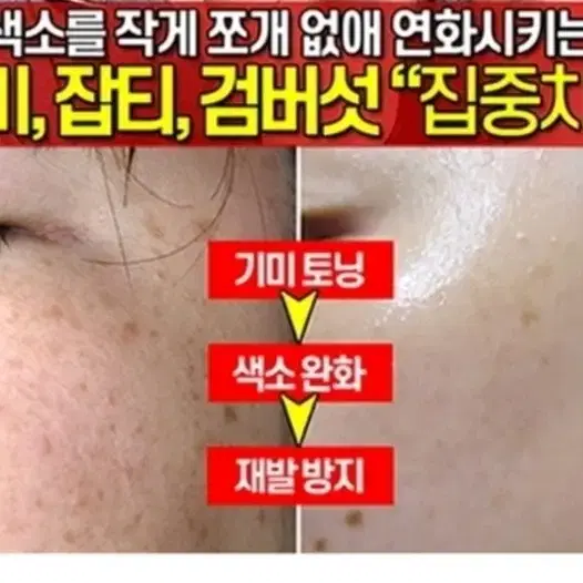 기미톡스 기미스틱 잡티스틱 기미앰플 미백 탄력 주름지우개  검버섯 네일