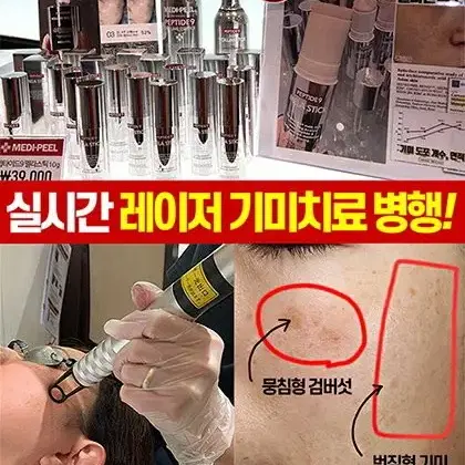 메디필 기미스틱 2개,3개 무료배송