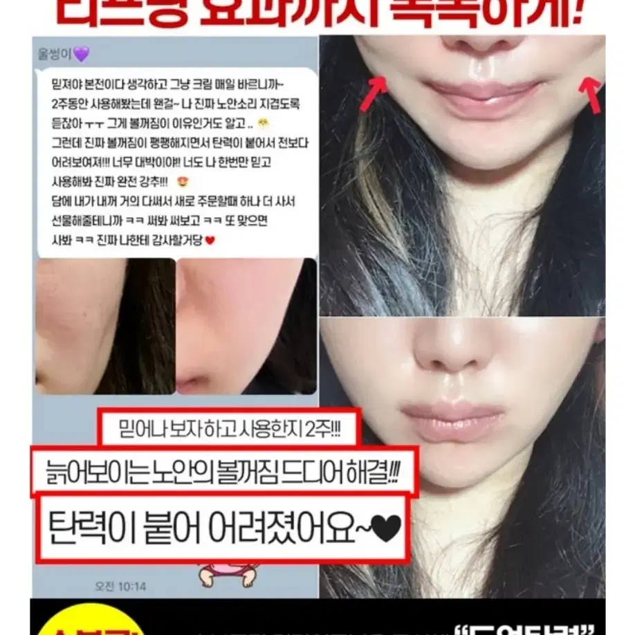 볼꺼짐 리프팅 필러 탄력 물광 보르피린 보톡스 주름개선 아이크림 팔자주름