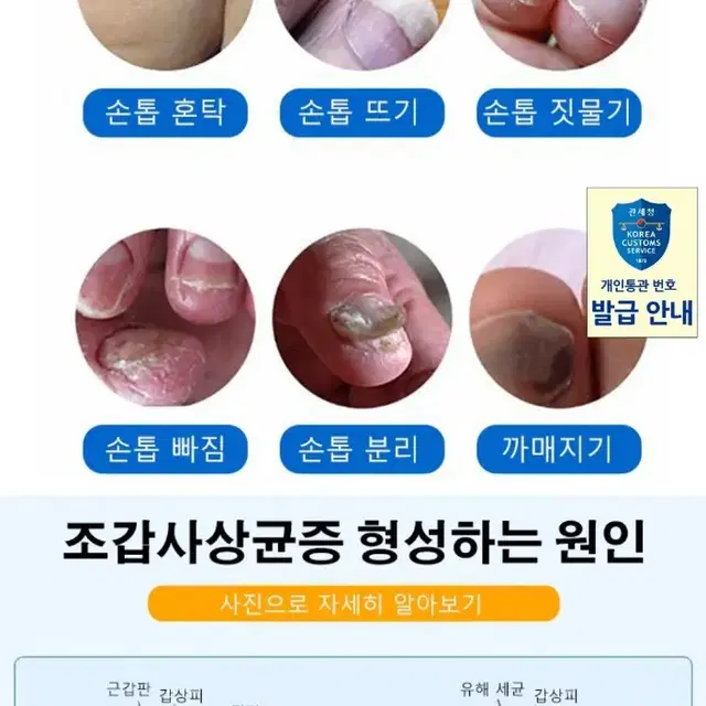 2일배송 손톱 복구 발톱 깨짐 재생