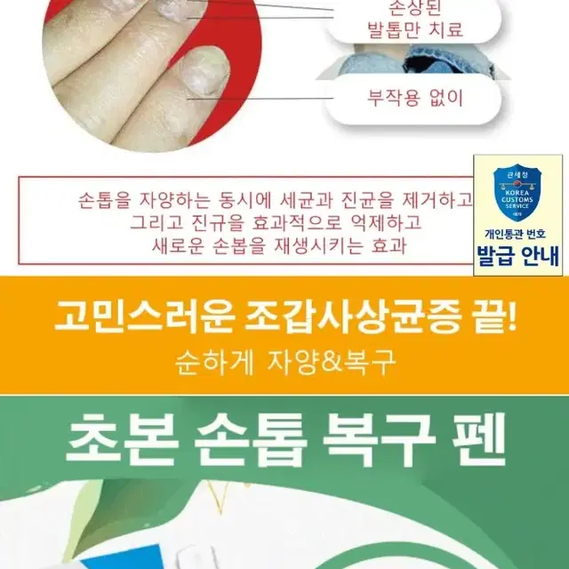 2일배송 손톱 복구 발톱 깨짐 재생