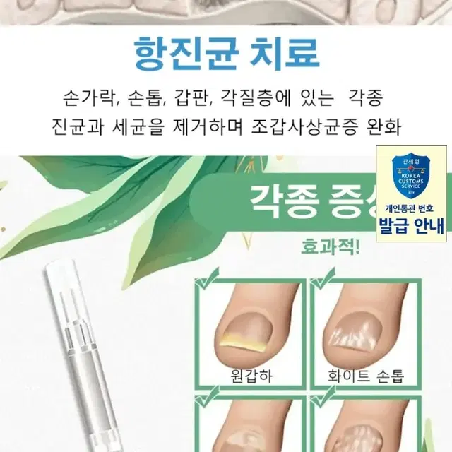 2일배송 손톱 복구 발톱 깨짐 재생