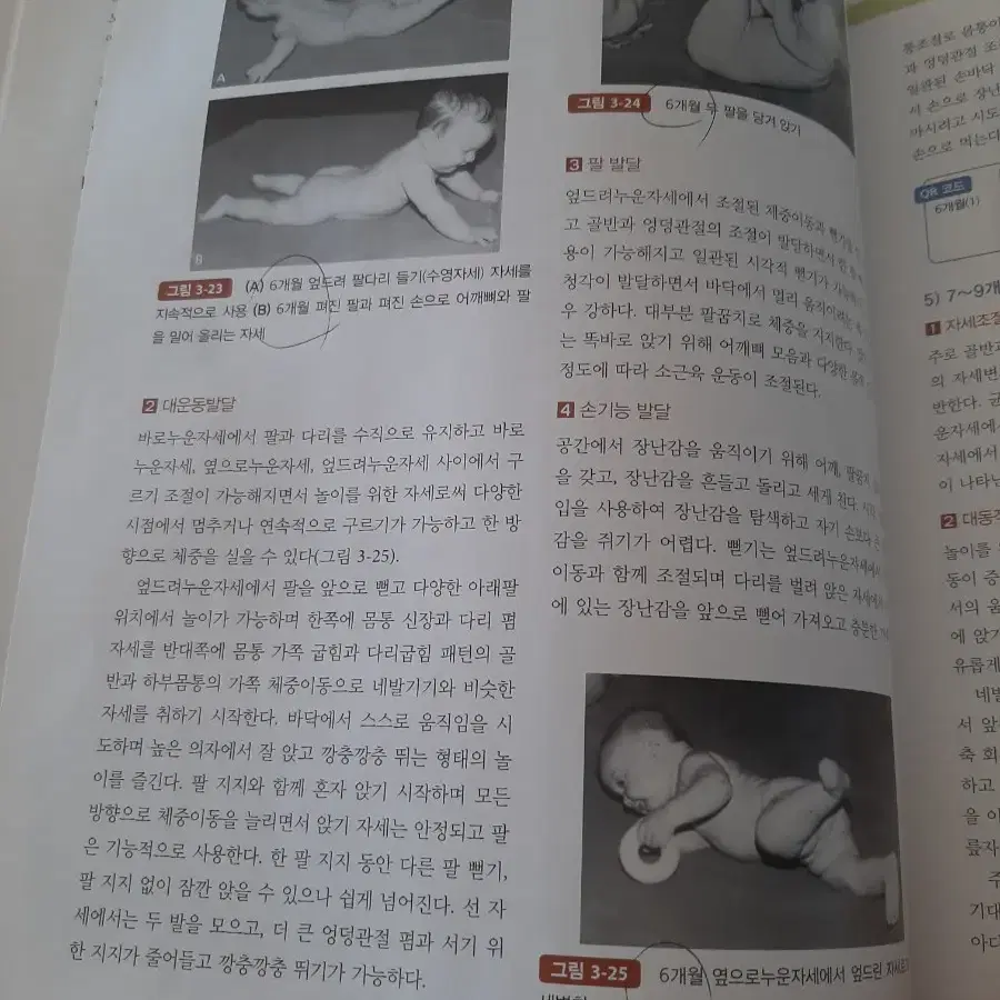 소아물리치료