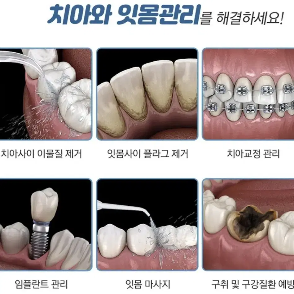 구강 세척기 세정기 구강케어 휴댜형 8단계 수압조절 무선 잇몸관리