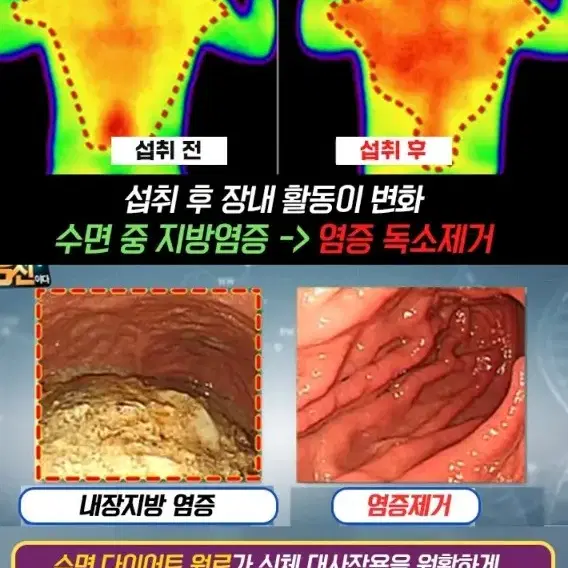 HWC잘자요 예쁜언니 자면서 살을 뺀다 수면도움주는 성분 다이어트