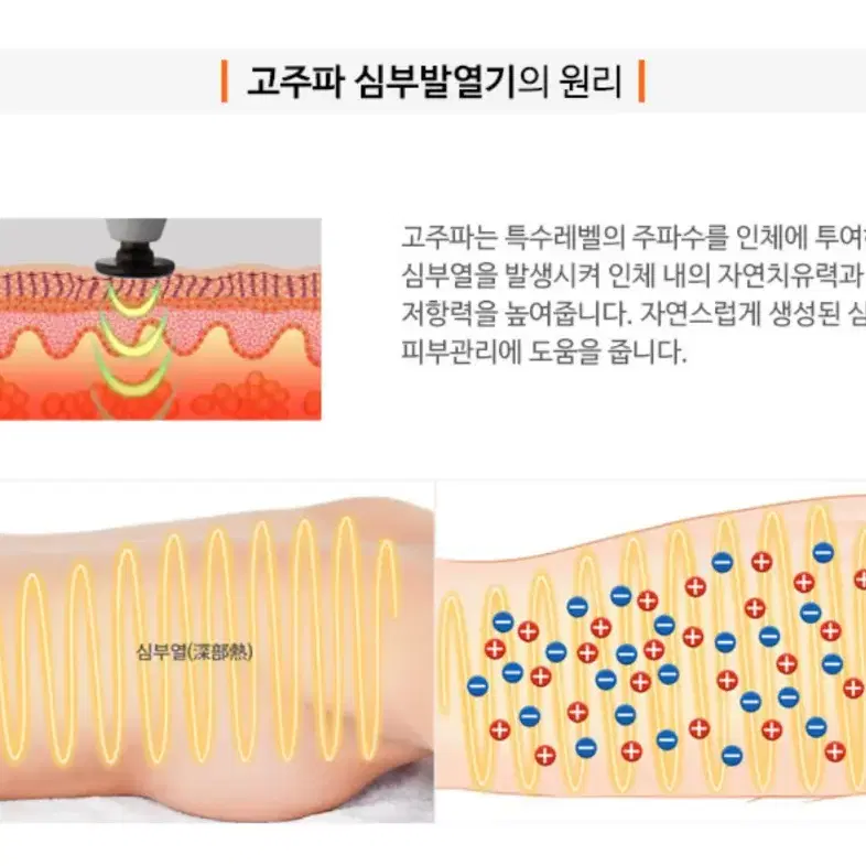 포야 고주파기기 뉴sm 미개봉 새 상품