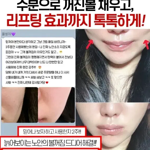 볼꺼짐크림 볼 꺼짐 이마, 볼,눈밑,주름화장품 필러 에센스 앰플 메디필