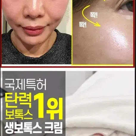 안전 바르는 보톡스 펩타이드 보르톡스 주름 볼륨 탄력 재생 메디필 크림