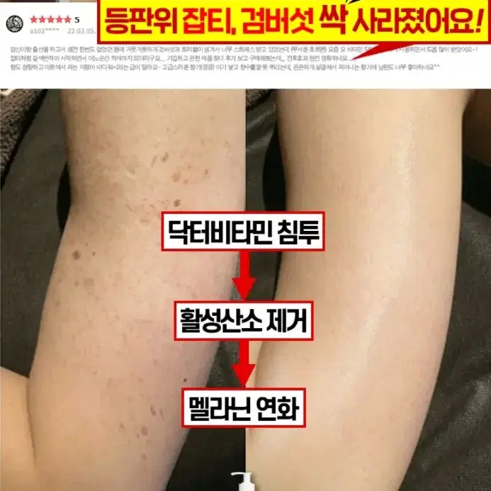 겨드랑이 색소침착 검버섯 닭살 전신미백 화장품 향수바디워시 미백비누메디필