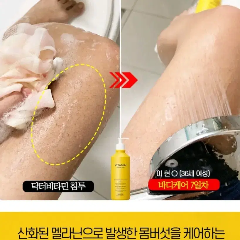 겨드랑이 색소침착 검버섯 닭살 전신미백 화장품 향수바디워시 미백비누메디필