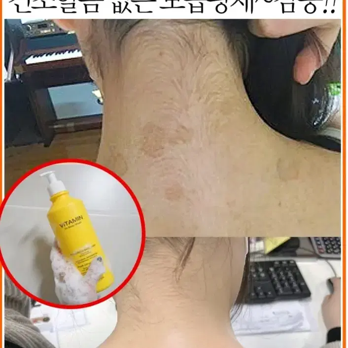 겨드랑이 색소침착 검버섯 닭살 전신미백 화장품 향수바디워시 미백비누메디필