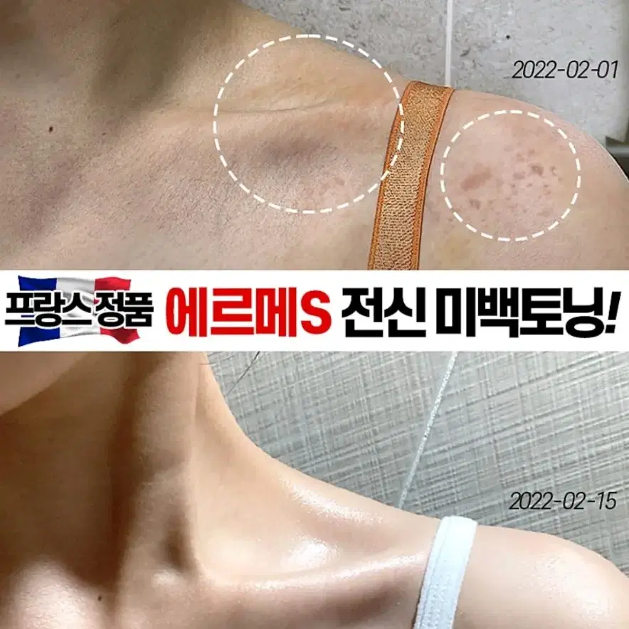 겨드랑이 색소침착 검버섯 닭살 전신미백 화장품 향수바디워시 미백비누메디필