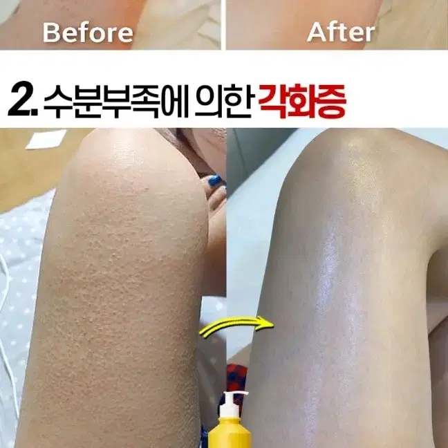 겨드랑이 색소침착 검버섯 닭살 전신미백 화장품 향수바디워시 미백비누메디필