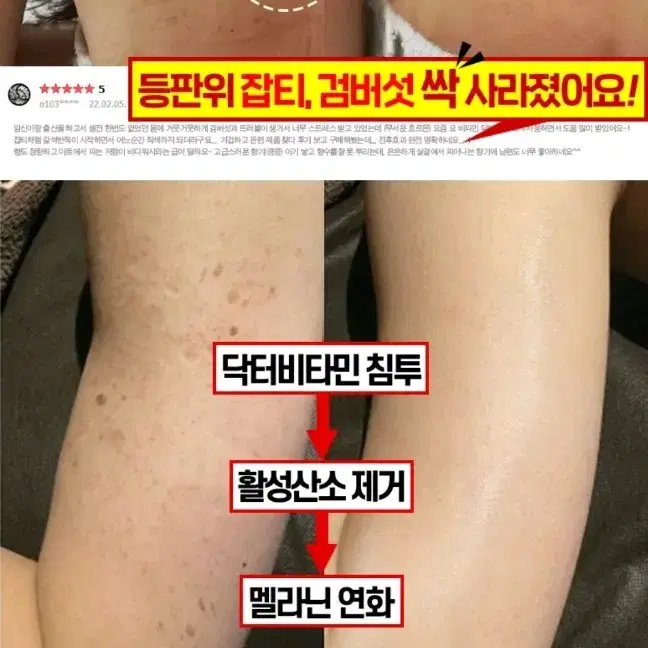 겨드랑이 색소침착 검버섯 닭살 전신미백 화장품 향수바디워시 미백비누메디필